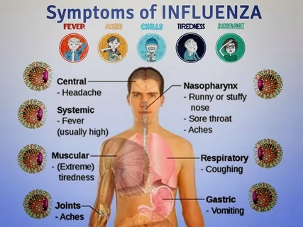 Influenza